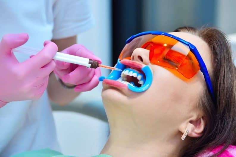 Get a brighter smile in minutes with instant results whitening Stockport