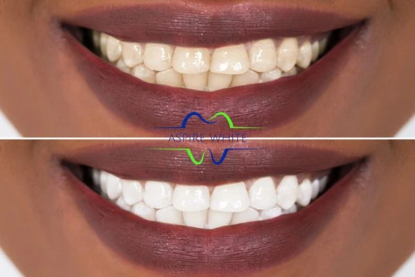 Side-by-side comparison showing before and after results of a cosmetic treatment Stockport