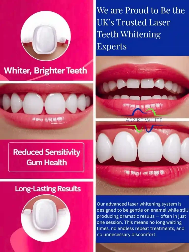 We are Proud to Be the UK’s Trusted Laser Teeth Whitening Experts Stockport