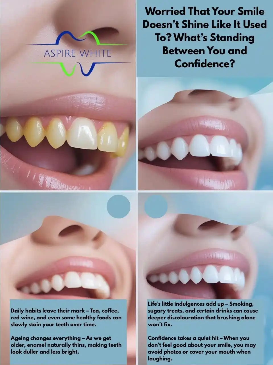Worried That Your Smile Doesn’t Shine Like It Used To What’s Standing Between You and Confidence Stockport